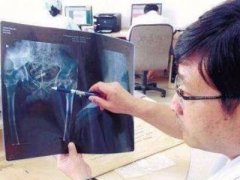 广州代妈18年没来姨妈 脱下裤子后惊呆众人