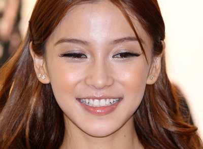 AngelaBaby牙齿矫正后瞬间变广州代妈