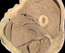 广州代妈生殖器官医学切片