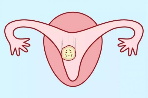 情绪不好,如何影响试管成功率?